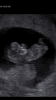 5A01A861-05D2-4422-8358-B096CA10184A.png