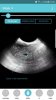 Screenshot_20181121-214446_Pregnancy +.jpg
