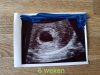 20181123_141559.jpg