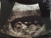 echo11w4d.jpg
