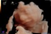 20181124_101259_baby poirters_201811240041.jpg