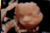 20181124_101259_baby poirters_201811240012.jpg