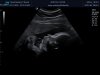 20181124_101259_baby poirters_201811240000.jpg