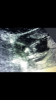 20398850-2F71-45D9-A4B0-7FDE7A9E9B57.png