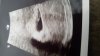 IMG-20181126-WA0001.jpeg