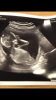 545F4E62-B2D5-4E84-BA96-2555FB0EF795.png