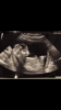 695AFAF7-2087-4E0C-8376-0BF45C3B0FF7.png