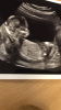 8531E114-D3D5-4262-A6F7-B8DD6BD4A281.png