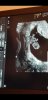Screenshot_20181204-155842_Video Player.jpg
