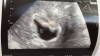 8F683CAD-9828-478D-B53F-6758F00CA9FC.png