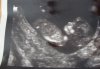 Echo 3 22-5-2012 a.jpg