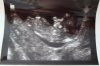 Echo 3 22-5-2012 b.jpg