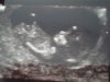 Echo 3 22-5-2012 h.jpg