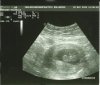 echo 30 mei 9w6d.jpg
