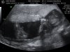 BABY_3.jpg