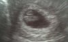 Echo 06062012.jpg