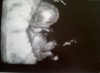 baby.jpg