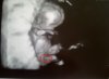 baby2.jpg
