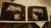 IMG-20181210-WA0001.jpeg