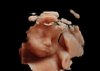 20181215_090234_BABY BOLTEN 31 WK_201812150024__01.jpg