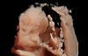 20181215_090234_BABY BOLTEN 31 WK_201812150005__01.jpg