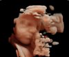 20181215_090234_BABY BOLTEN 31 WK_201812150022__01.jpg