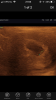 997E8ABA-6427-4961-A32E-51B1A7199EB0.png