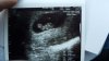 IMG-20181224-WA0006.jpeg