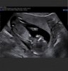 Screenshot_20181224-161856_Hello Mom.jpg