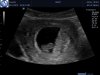 J180257_1823874_Echo.Jpg