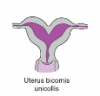 uterus bicornis.PNG
