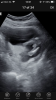 7CCD56F8-923C-48BF-A256-4433AE8873F1.png