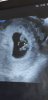 Screenshot_20190111-135643_Gallery.jpg