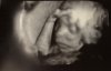Baby.jpg