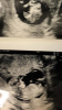 7224C8A2-FF72-4684-93F3-04FC237B6917.png