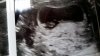 20190121_100816.jpg
