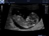 J180257_1864418_Echo.Jpg