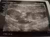 20190125_104517.jpg