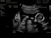 19-01-26-120427_VROON_20190126_122354_0008.jpg