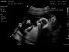 19-01-26-120427_VROON_20190126_122354_0027.jpg