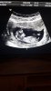 IMG-20190117-WA0016.jpeg