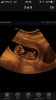 2F189A20-F7D4-41E4-92B8-B38182E23F13.png