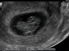 2019-02-01 18.55.16.jpg