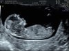 12wk5dg_29.jpg