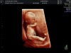 12wk5dg_24.jpg