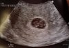 FB_IMG_1491287540169.jpg