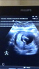 041FA1FF-AEB8-4F35-9529-59BCE0F45630.png
