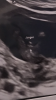 AEBDD905-90E7-4ABE-81FF-F394A5E40616.png