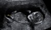 4387C542-F079-4BED-9998-31998E477531.jpeg