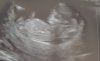 20190208_080717.jpg
